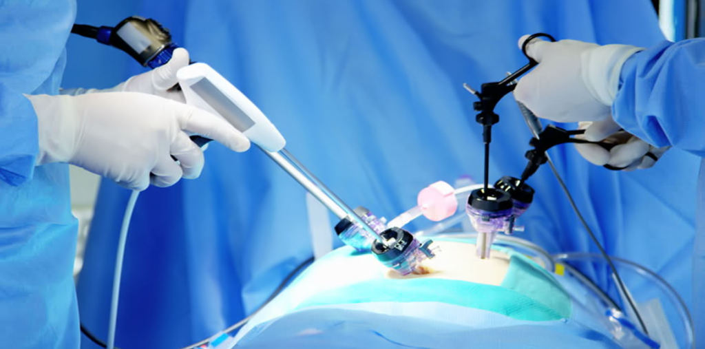 Neuroendoscopy Devices Market