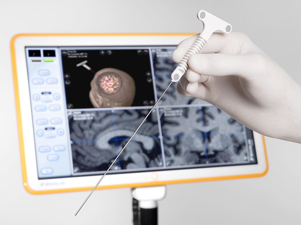 Neuronavigation Systems Market