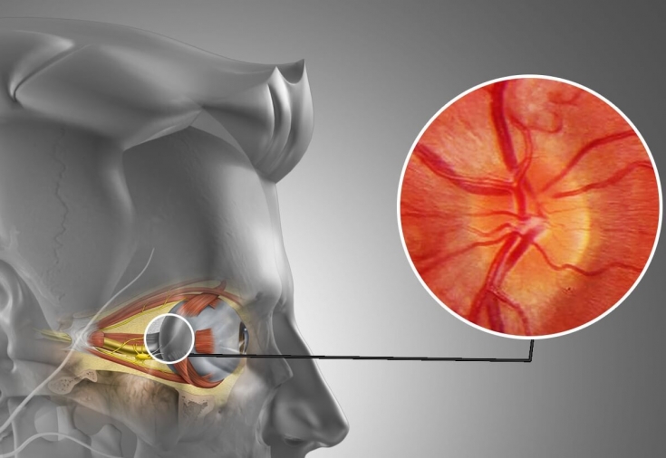 Orbital Tissue Expander Market