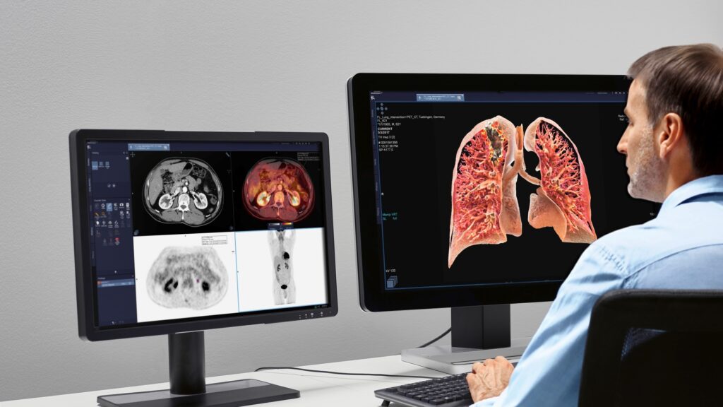 Radiology Information System (RIS) Market