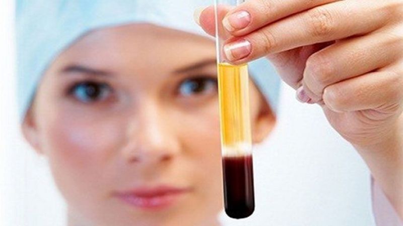 European Platelet Rich Plasma (PRP) Market