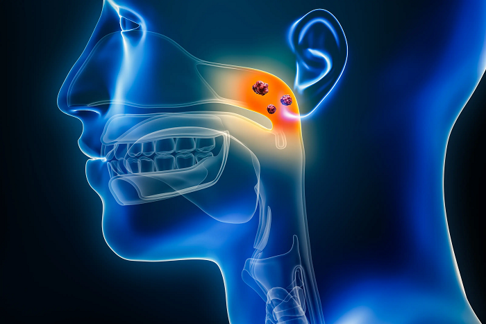 Nasopharyngeal Carcinoma Treatment Market