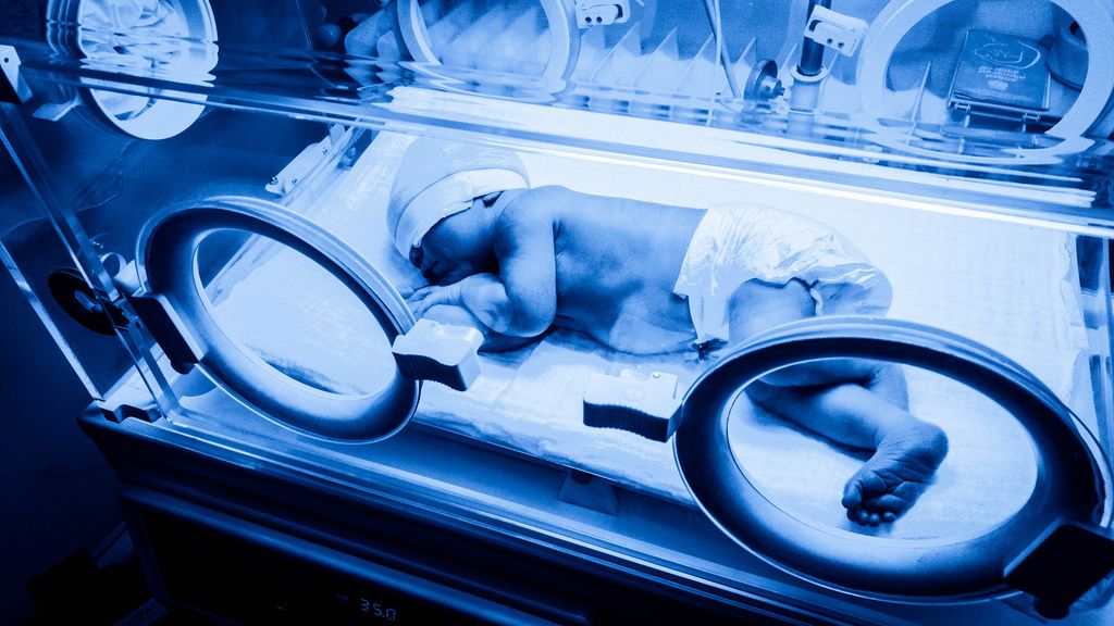 Neonatal Phototherapy Devices Market