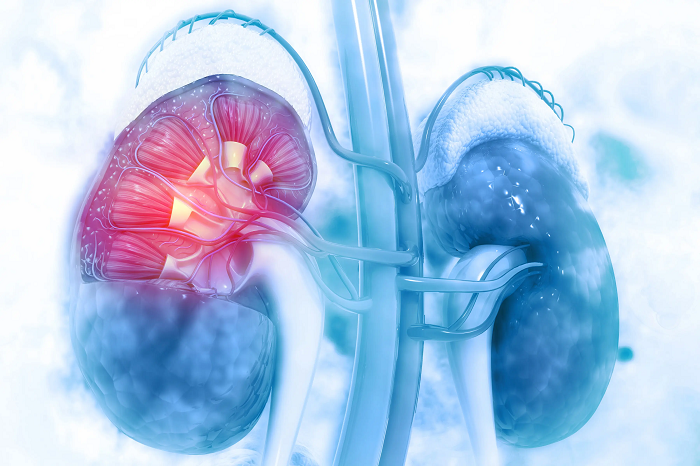 Nephroblastoma Therapeutics Market