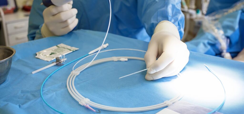 Global Neurovascular Guidewires Market