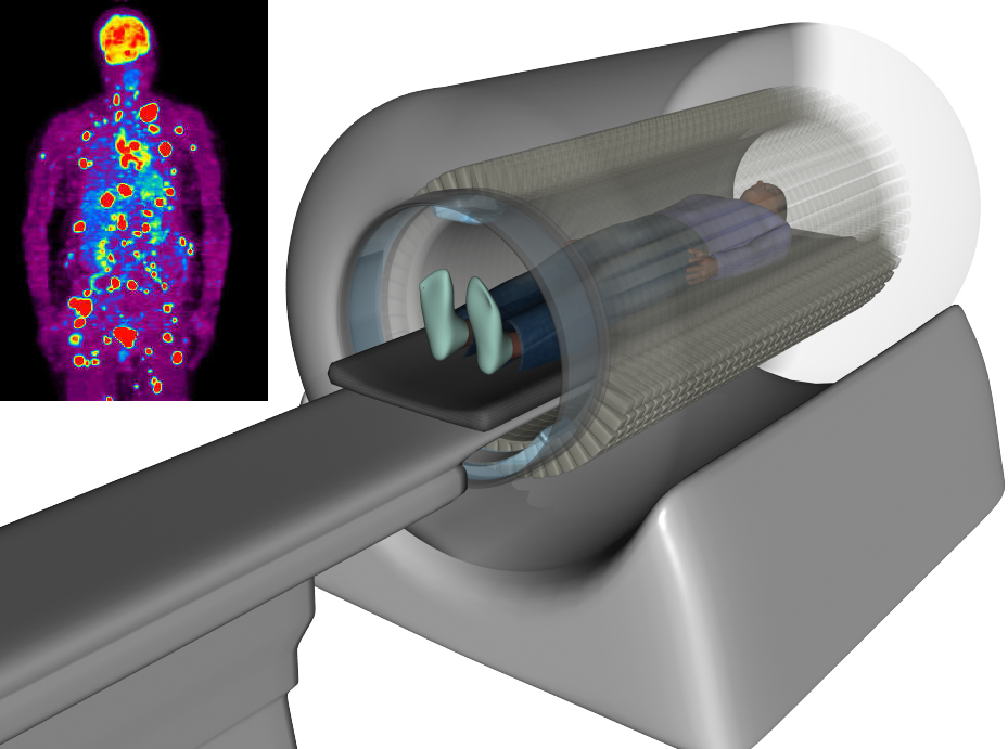 Positron Emission Tomography (PET) Scanners Market