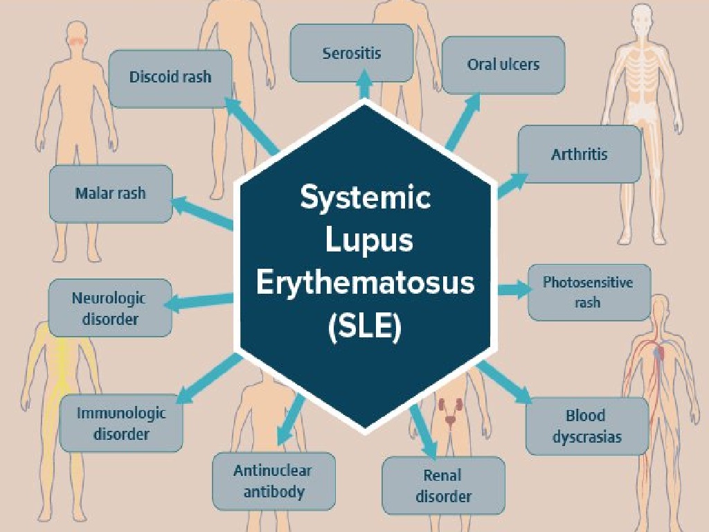 Systemic Lupus Erythematosus (SLE) Drugs Market