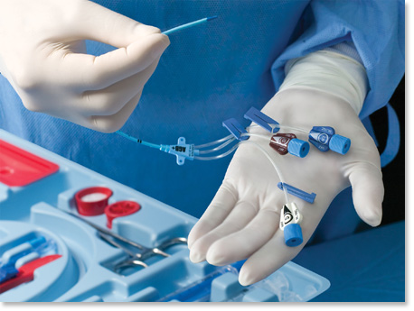 Vascular Access Devices Market