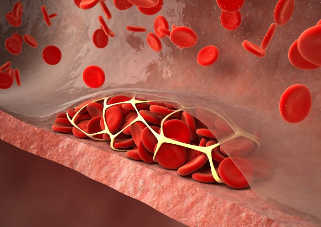 Venous Thromboembolism Treatment Market