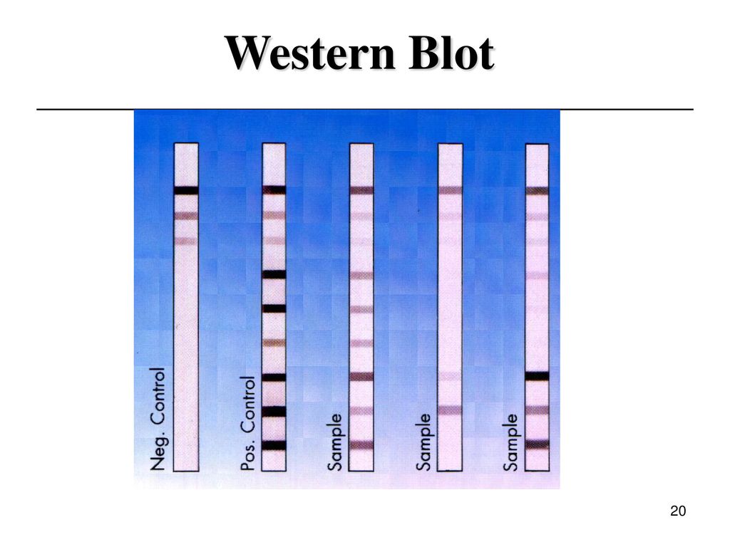 Western Blotting Market