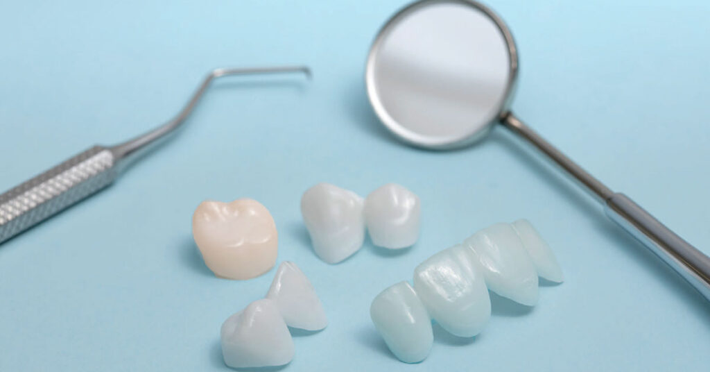 Zirconia Based Dental Ceramics Market