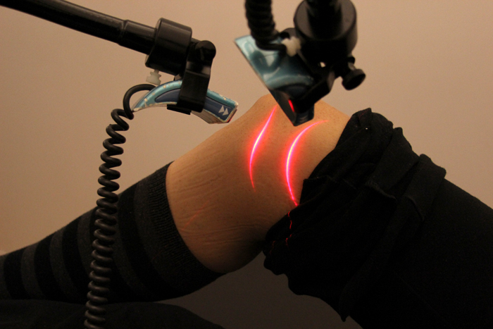 Cold Laser Therapy Market