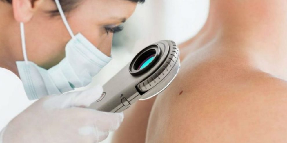 Dermatology Devices Market