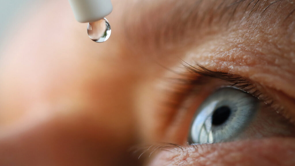 Dry Eye Syndrome (DES) Treatment Market