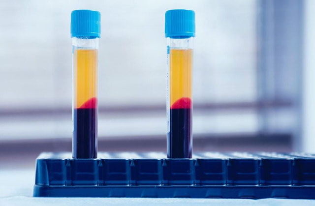 European Platelet-Rich Plasma (PRP) Market