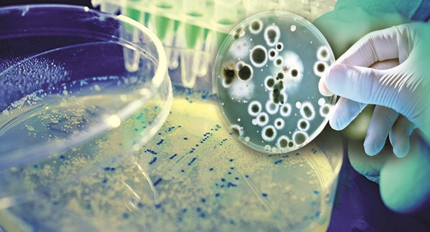 Global Microbial Fermentation Technology Market