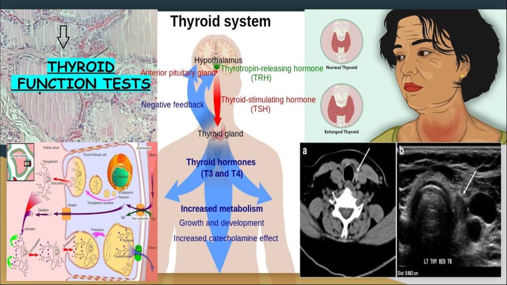 India’s Thyroid Function Test Market