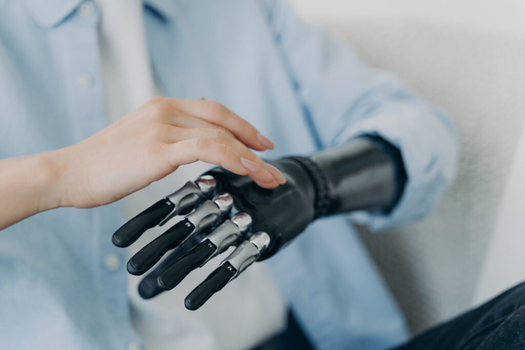 Intelligent Prosthetics Market