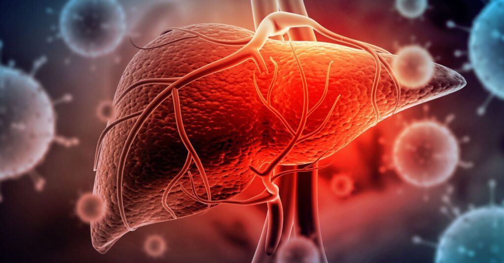 Liver Fibrosis Treatment Market