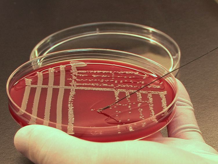 Methicillin-Resistant Staphylococcus Aureus (MRSA) Treatment Market