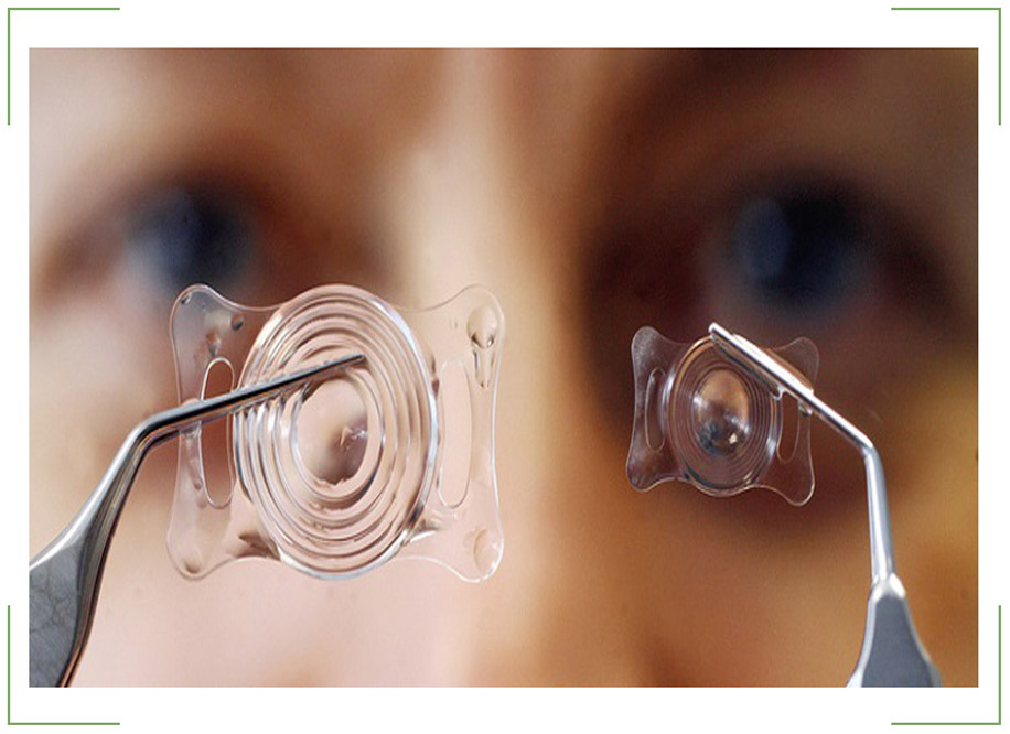 Phakic Intraocular Lenses (IOL) Market