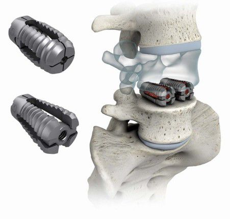 Spinal Fusion Market