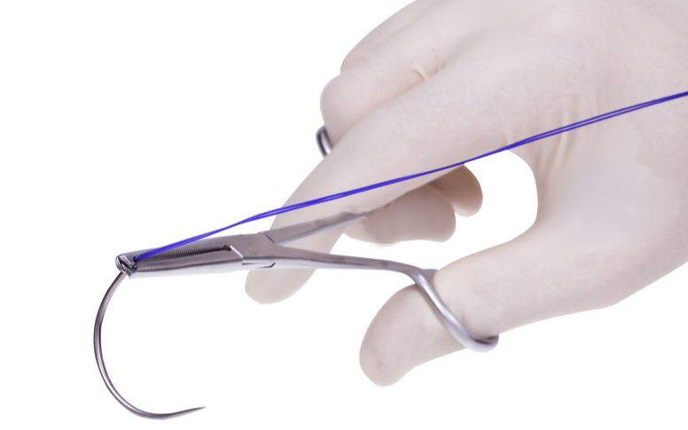 USA Knotless Surgical Sutures Market