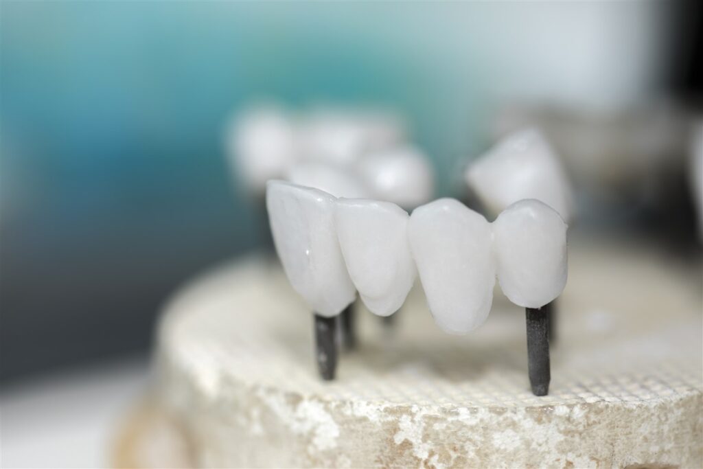 Zirconia-Based Dental Ceramics Market