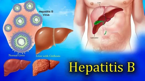 Global Chronic Hepatitis B Virus Testing Market