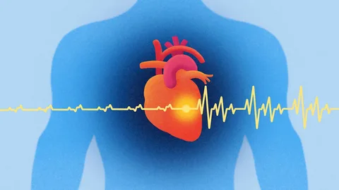 Global Ventricular Fibrillation Treatment Market