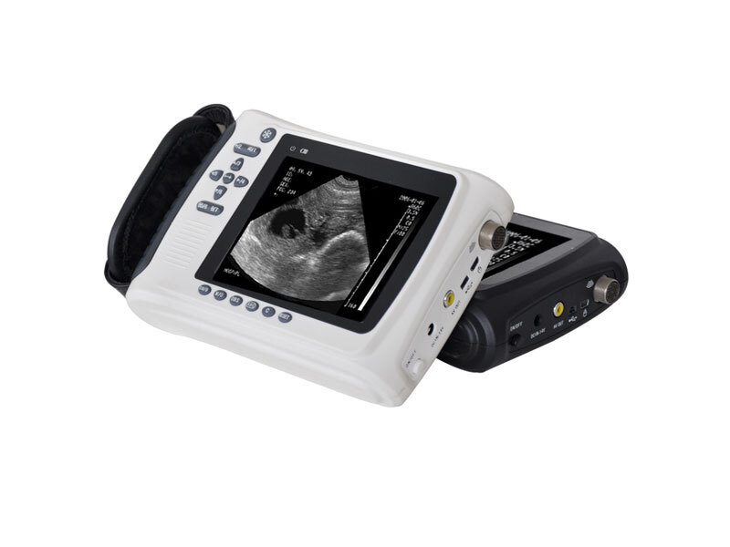 Handheld Ultrasound Equipment Market