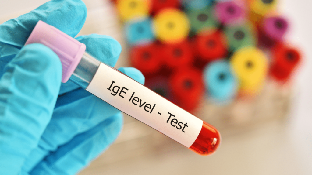 IgE Allergy Blood Test Market