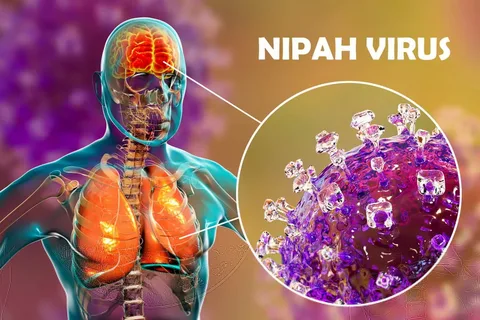 Nipah Virus Infection Testing Market