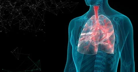 Radiation-Induced Fibrosis Treatment Market