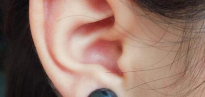 Bio-Magnetic Ear Stickers Market