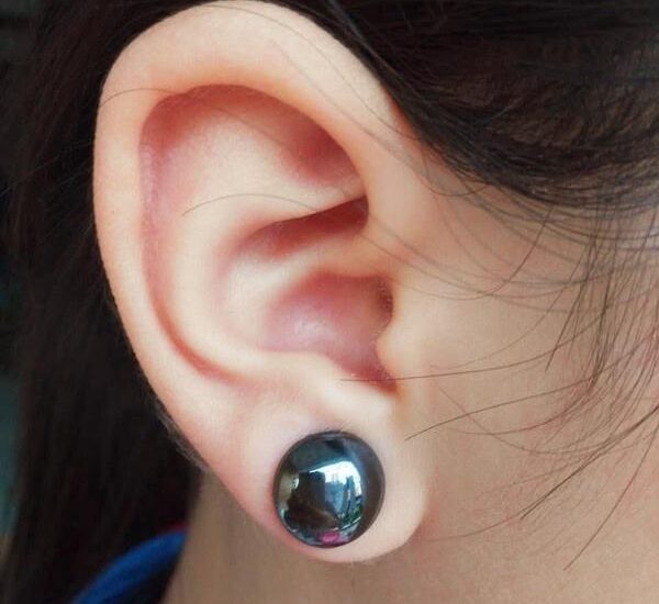 Bio-Magnetic Ear Stickers Market