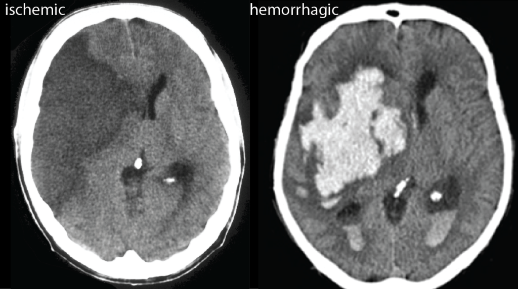 Hemorrhage Control System Market