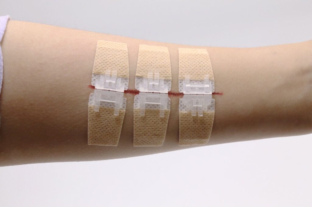 Hemostats for Wound Closure Market