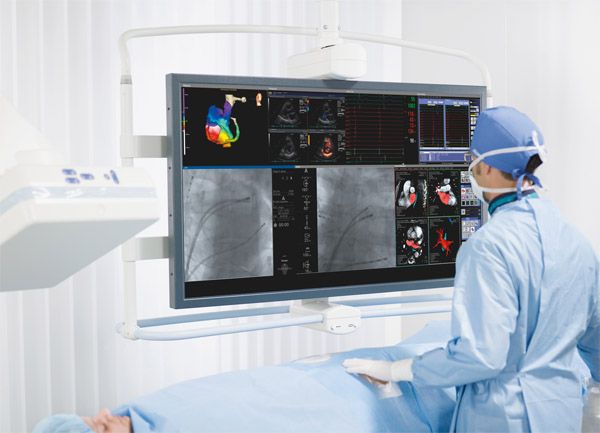 Interventional Cardiology Devices Market