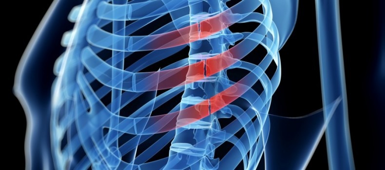 Rib Fracture Repair Systems Market