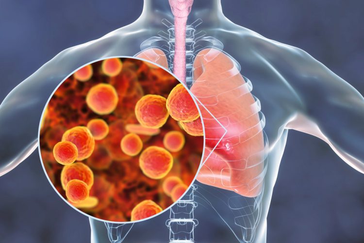 Community Acquired Bacterial Pneumonia (CABP) Treatment Market