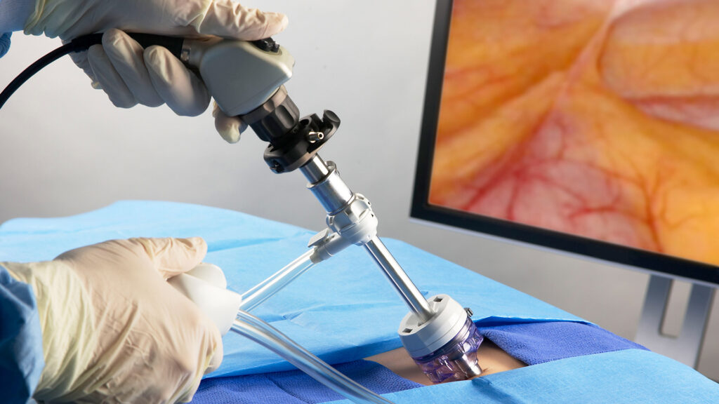 Endoscopic Closure Systems Market