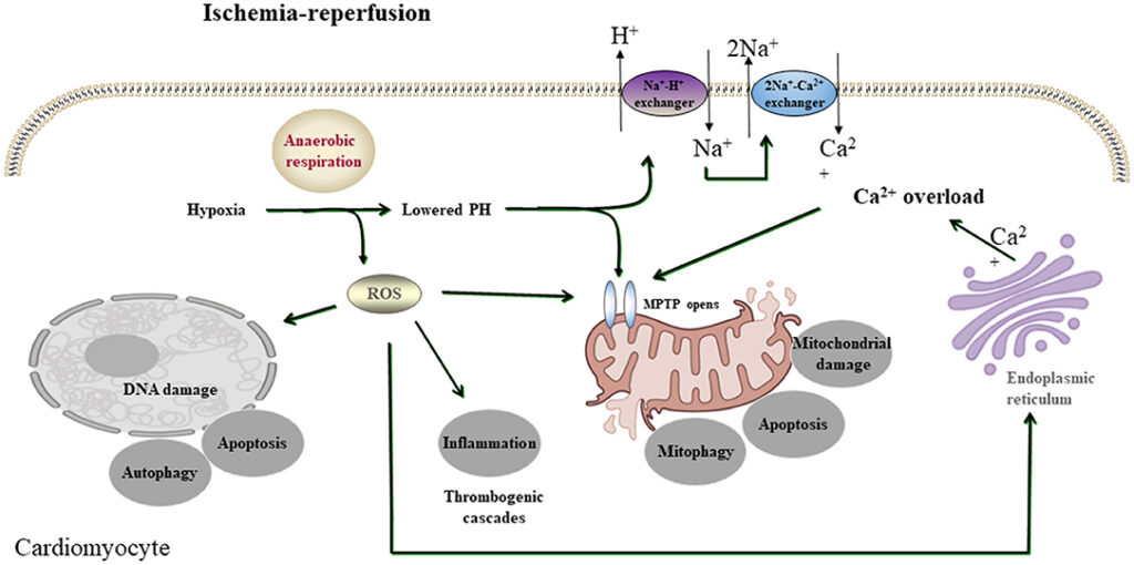 Ischemia Reperfusion Injury Treatment Industry