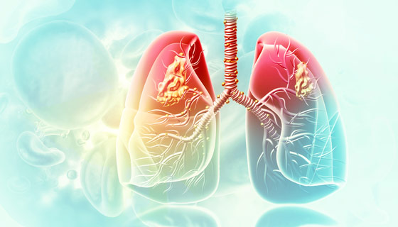 Lung Disease Therapeutics Market