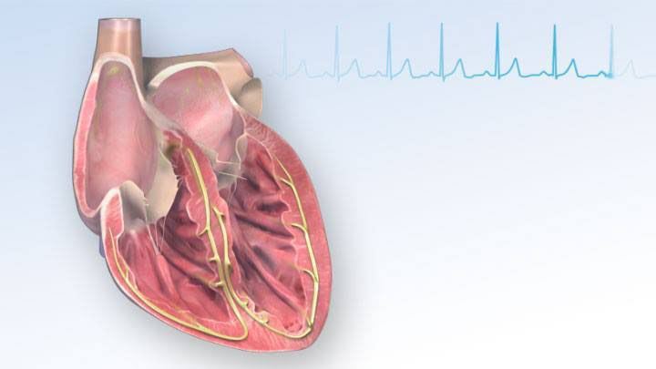 Ventricular Fibrillation Treatment Industry