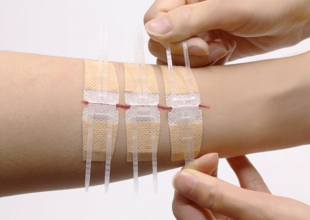 Wound Evacuators Market