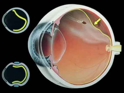 Retinal Biologics Industry